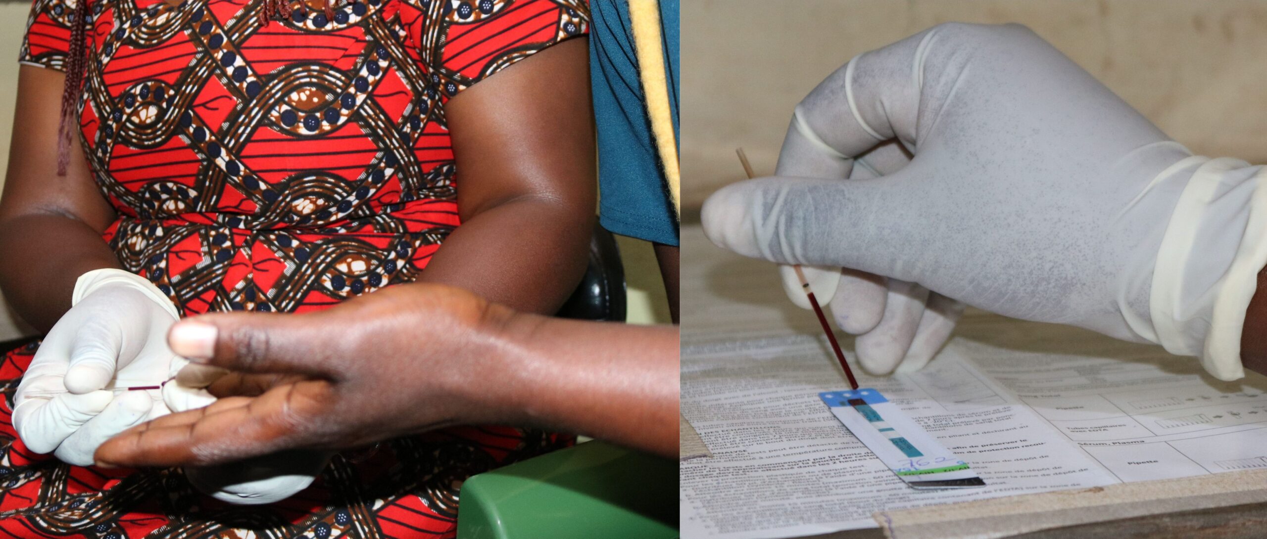HIV Prevention, Care & Treatment